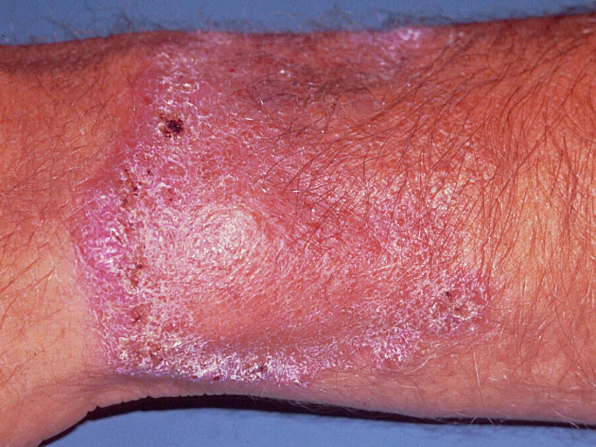 Unknown 79 clinical presentation