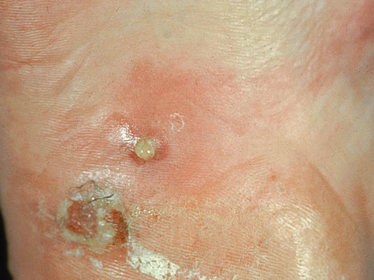 Unknown 80 clinical presentation