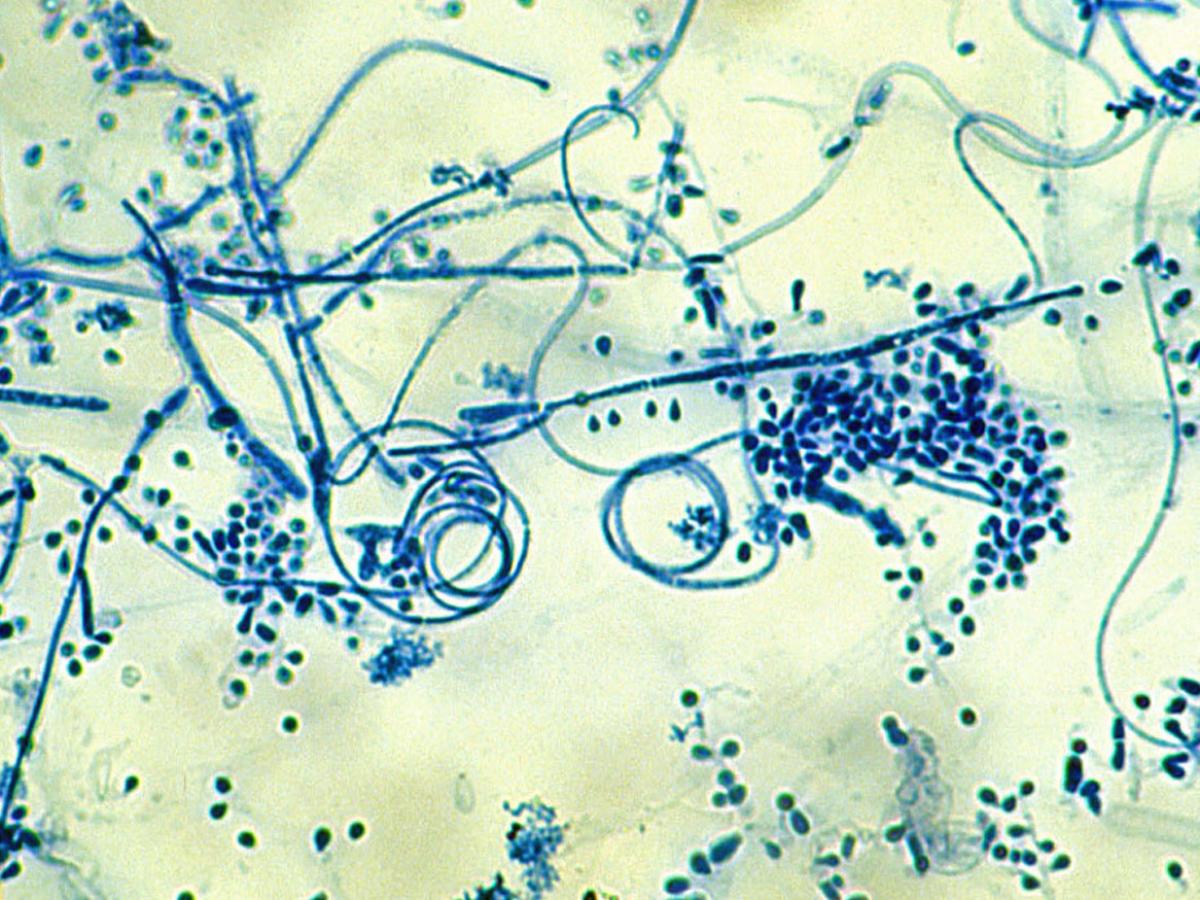 Unknown 80 microscopy - 1