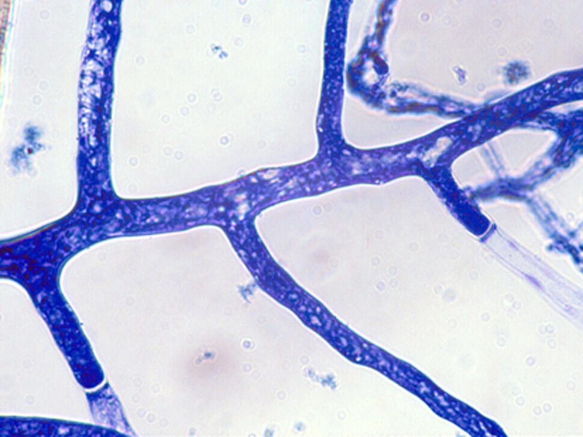 Unknown c microscopic morphology