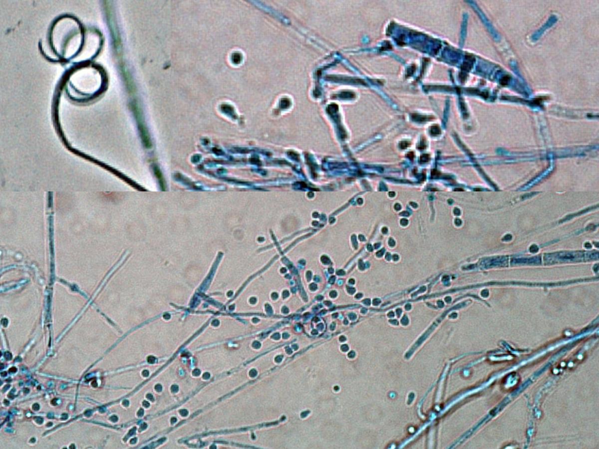 Fig. 2. Trichophyton indotineae micro