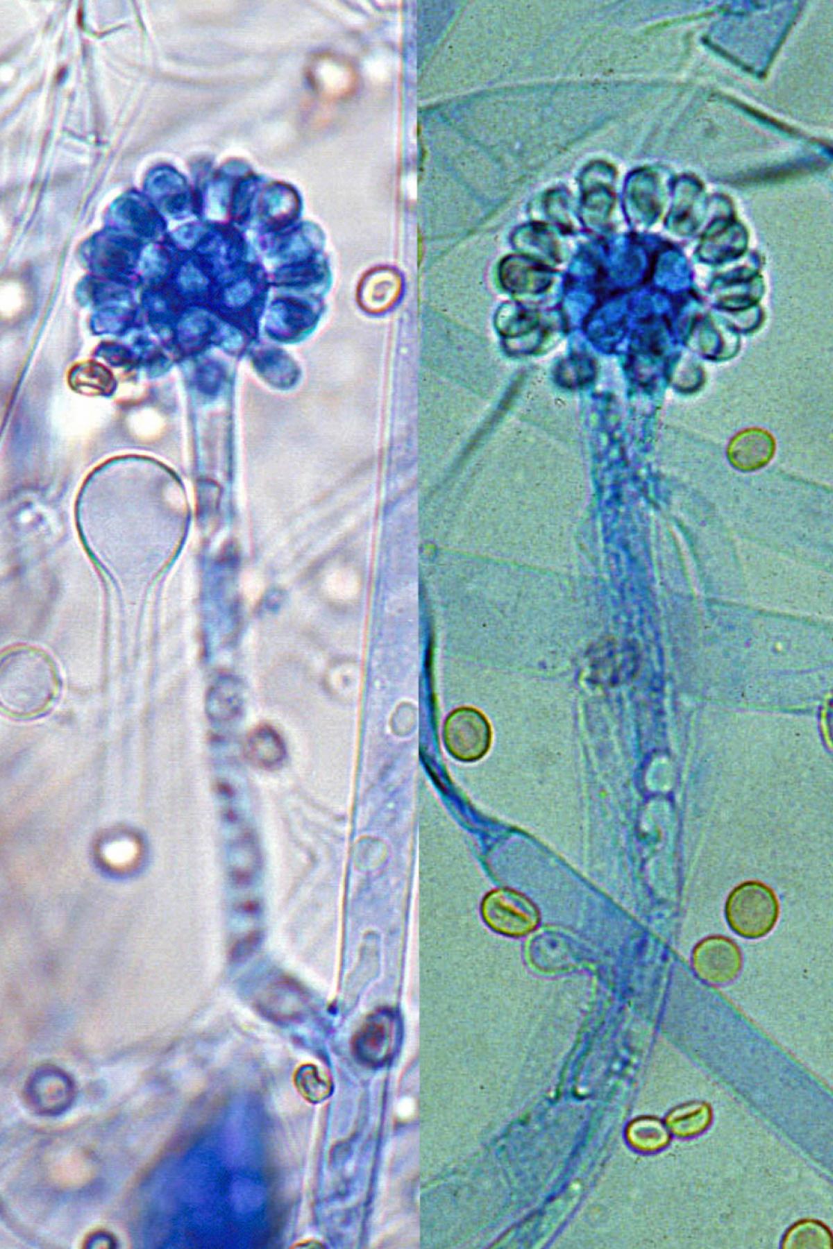 Cunninghamella microscopy