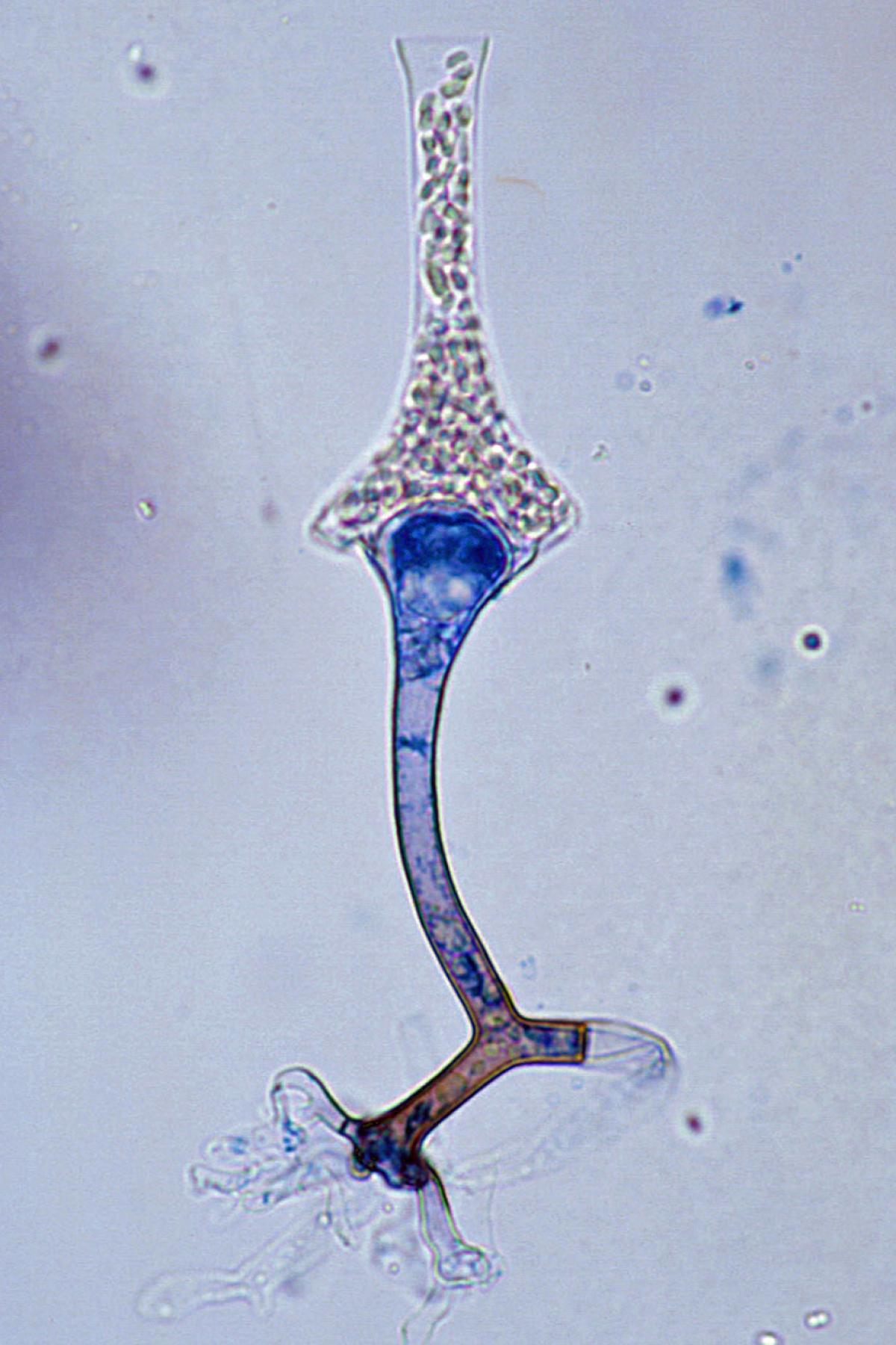 Saksenaea microscopy