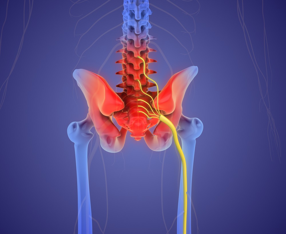 Can nerve implant help vegetative state