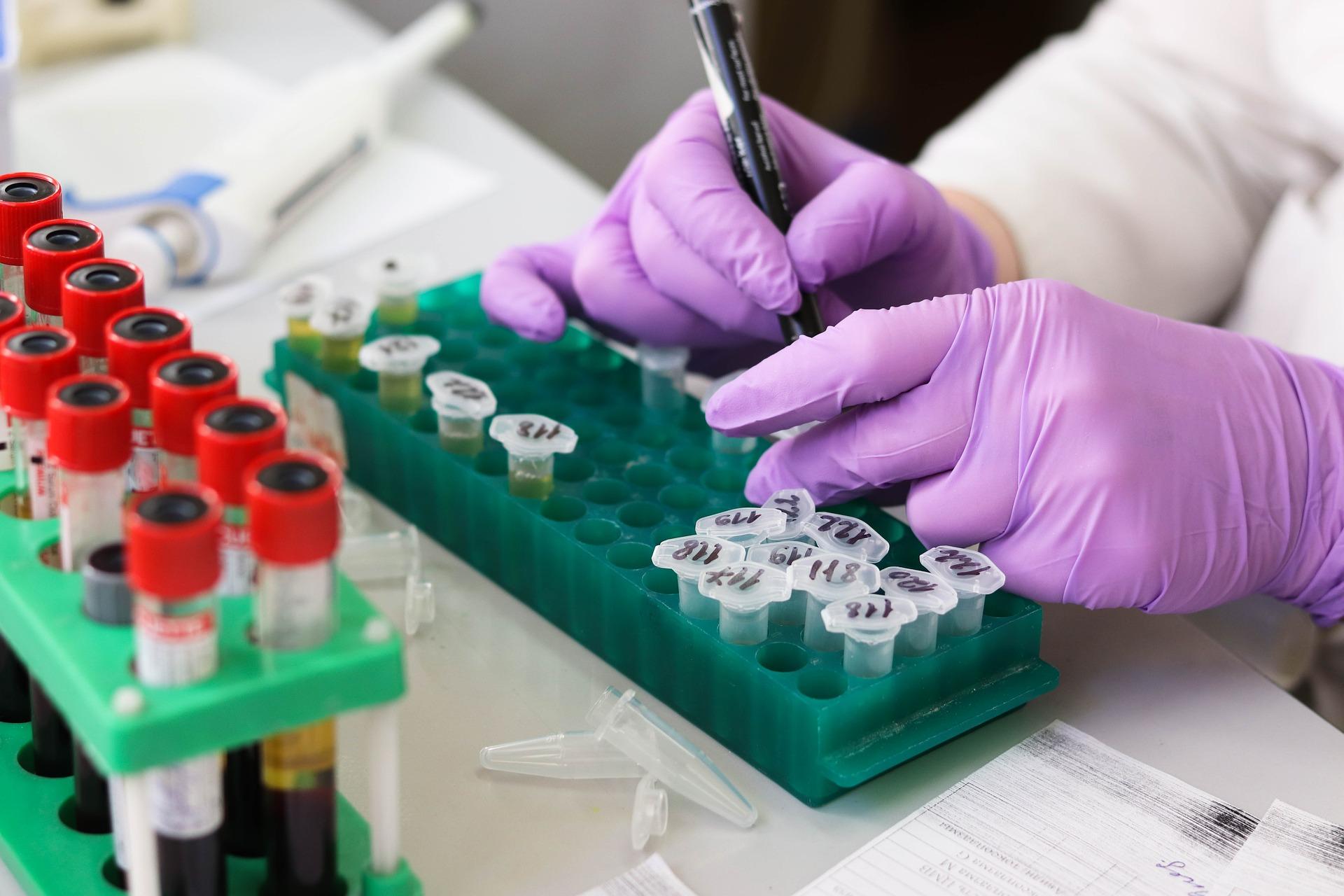 Image of vials in a medical laboratory