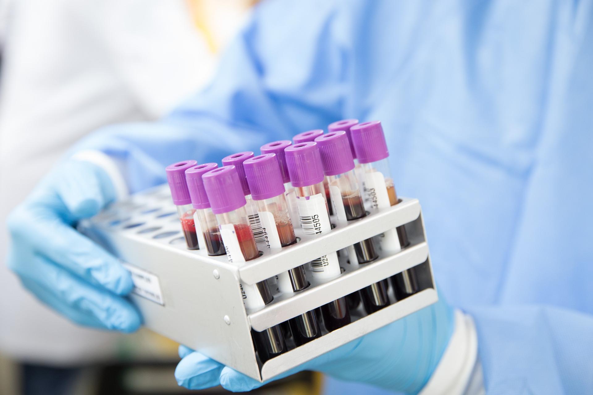 Image of blood vials in a laboratory