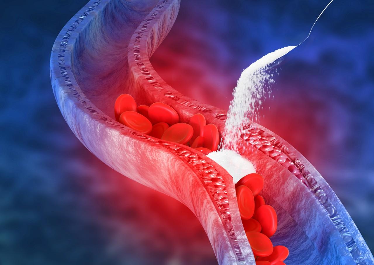 Graphic of vein