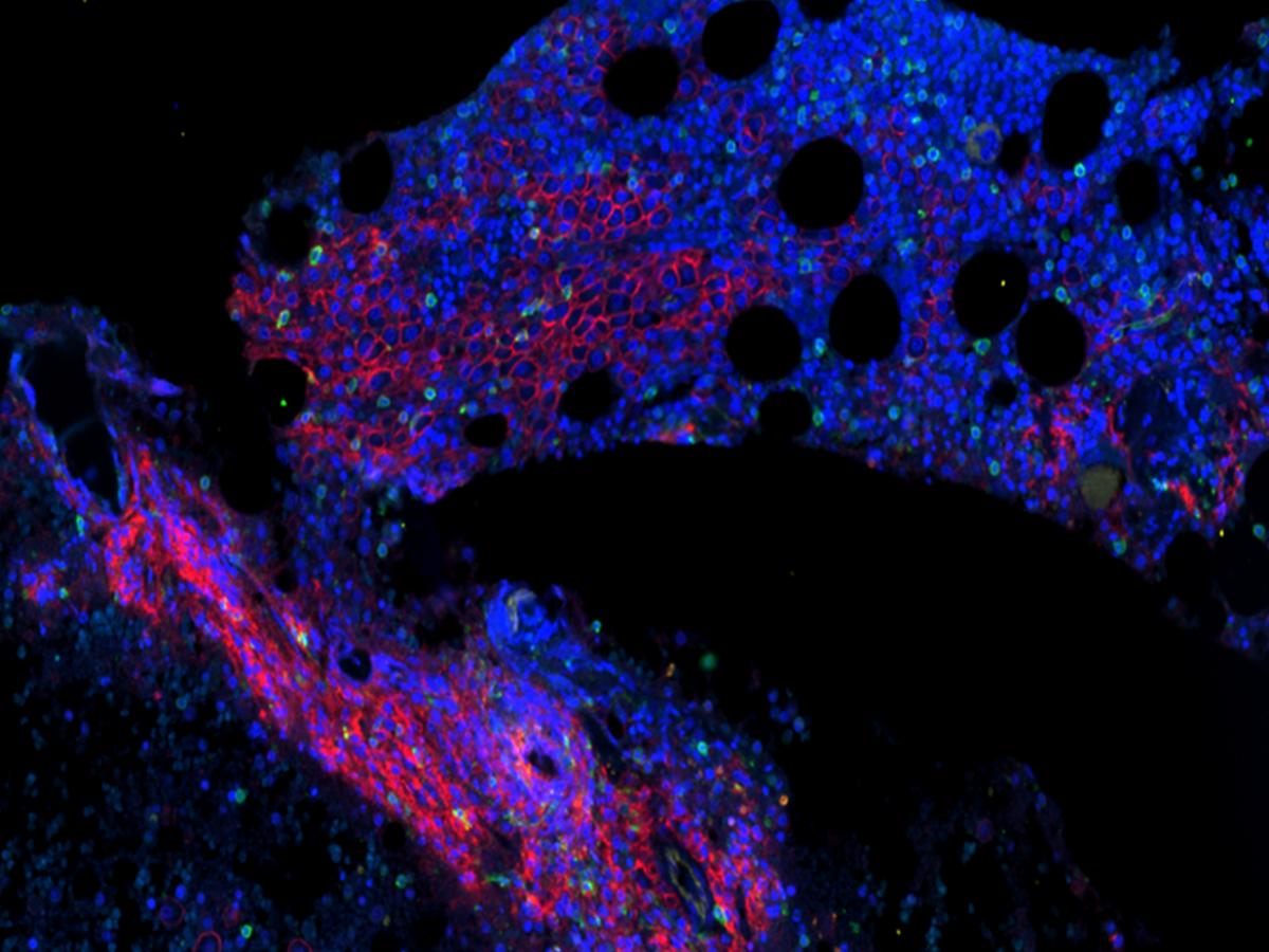 Spatial Transcriptomics and Proteomics Symposium