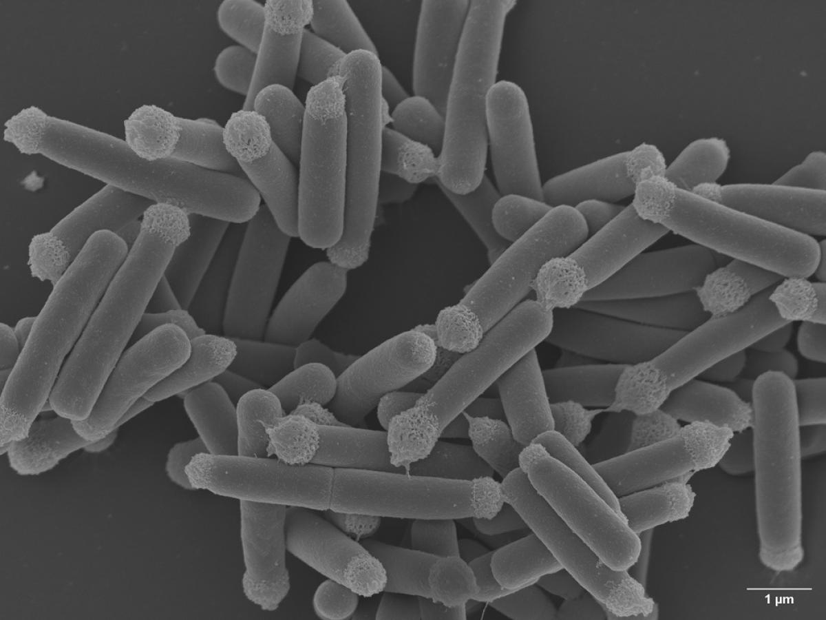 A group of single cells of Nicolia spurrieriana imaged by scanning electron microscopy. 