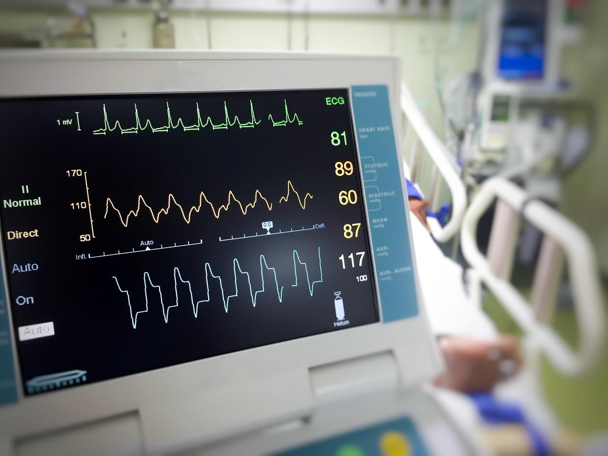 Photo of a heart monitor.
