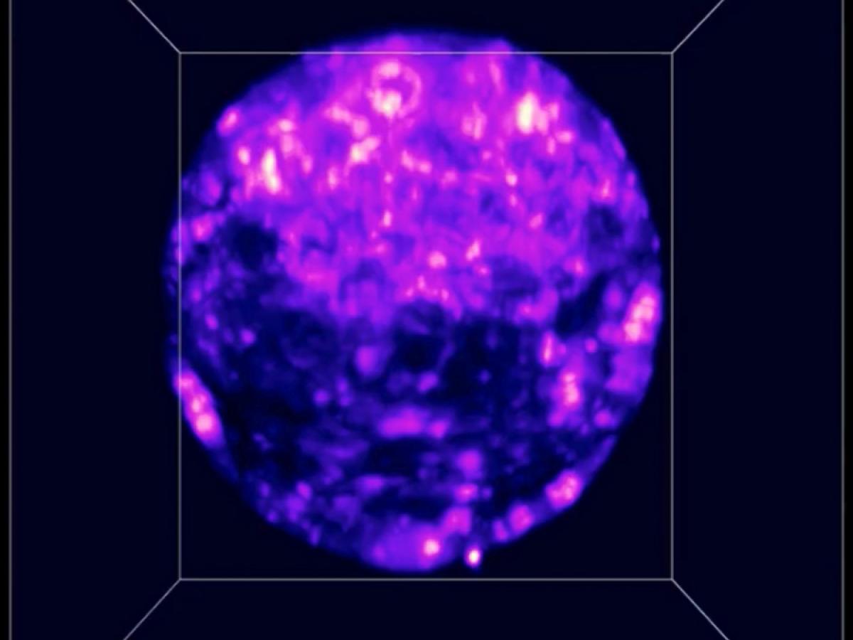 A 3D scan of an embryo created using light microscopy.
