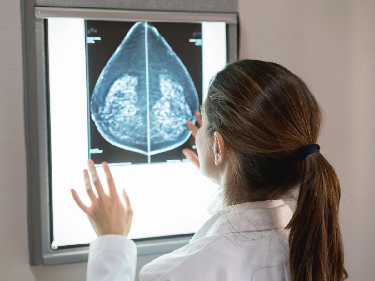 mammogram