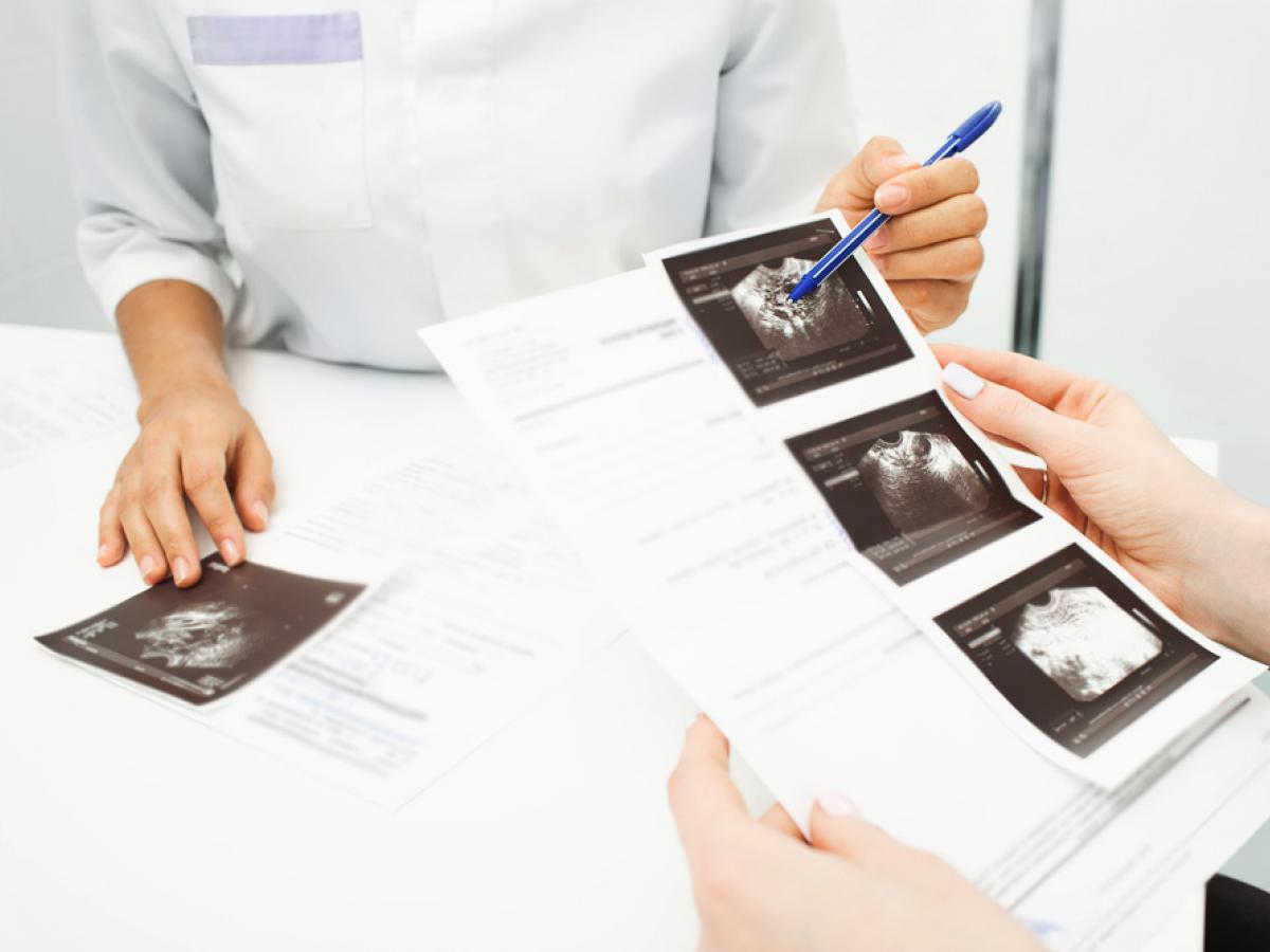Clinicians discuss transvaginal ultrasound images.