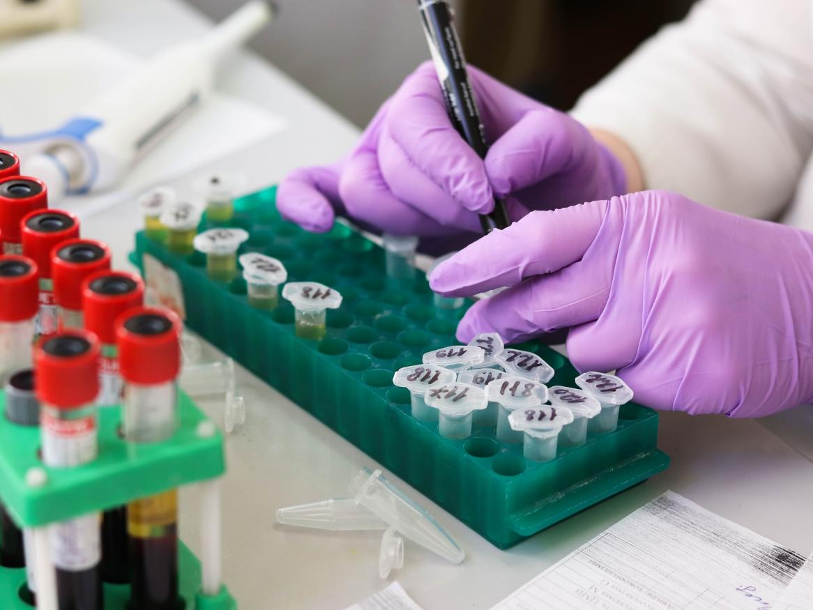 Image of vials in a medical laboratory