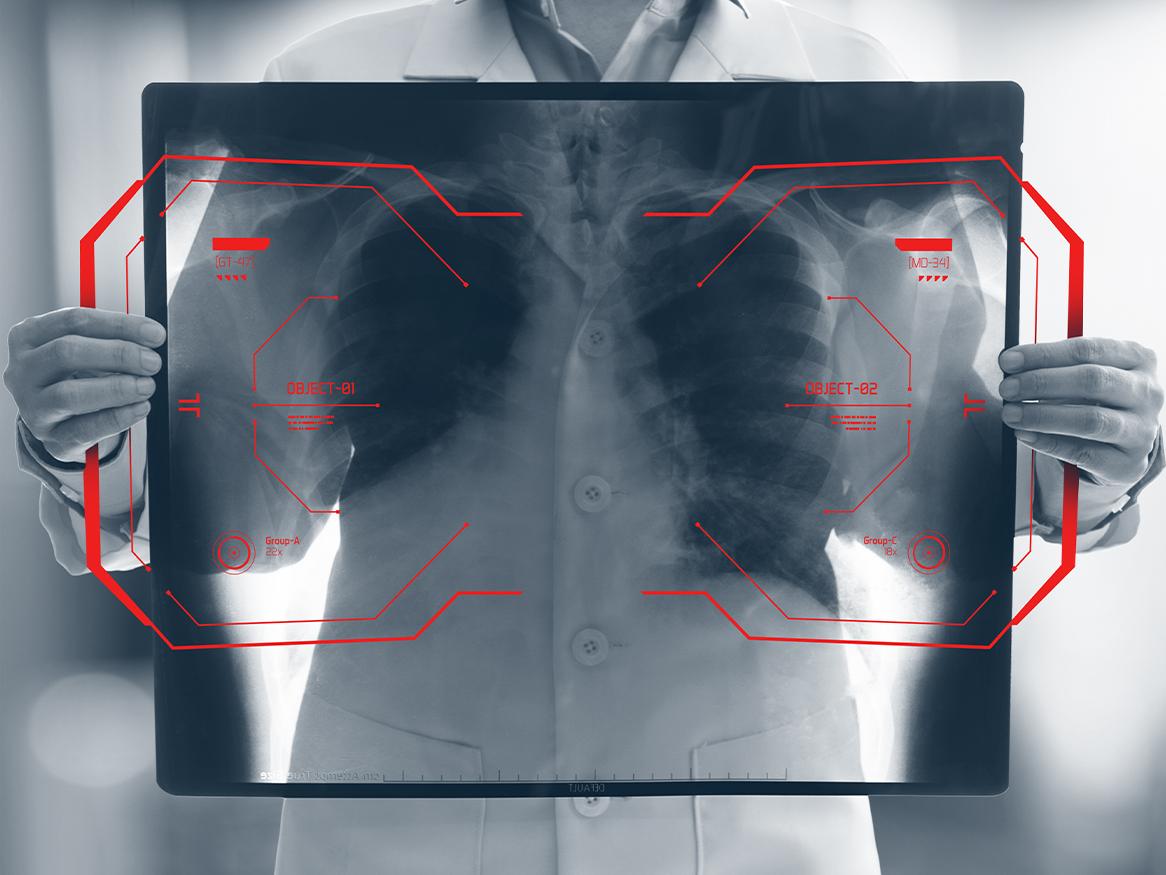 An x-ray image of a doctor's chest.