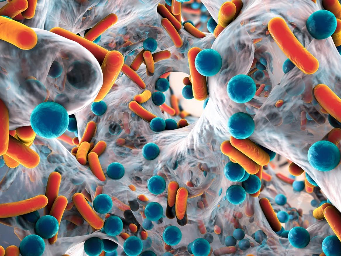 Image of antibiotic resistant bacteria