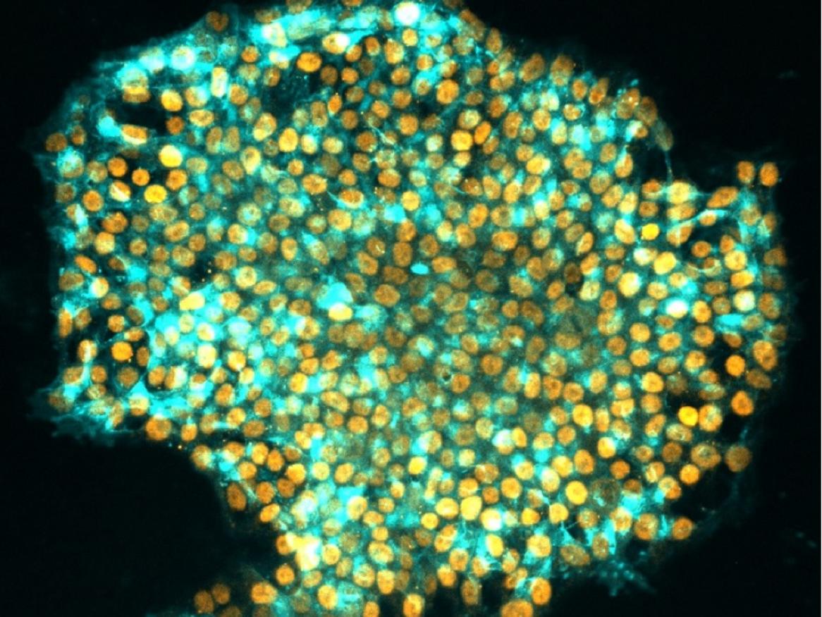 A photo of human iPS cells