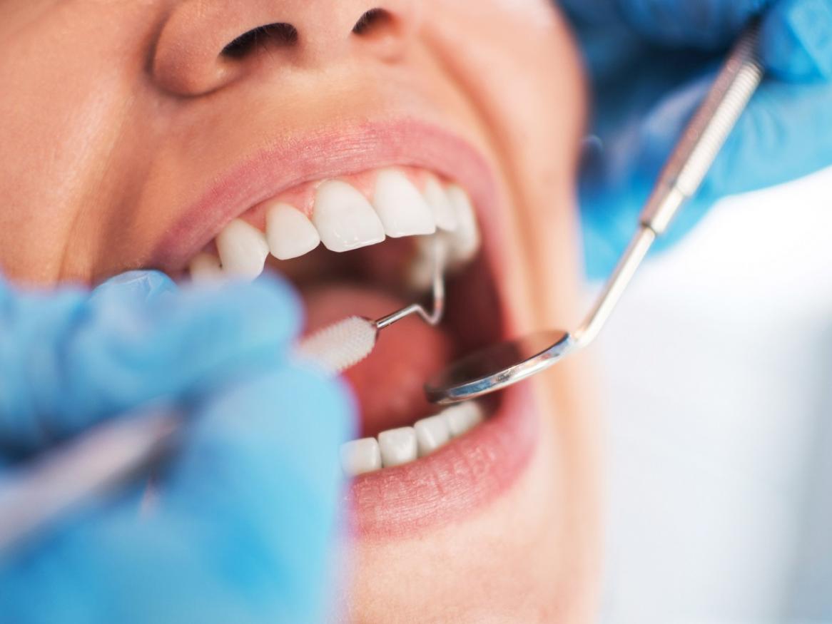 Photo of woman at the dentist