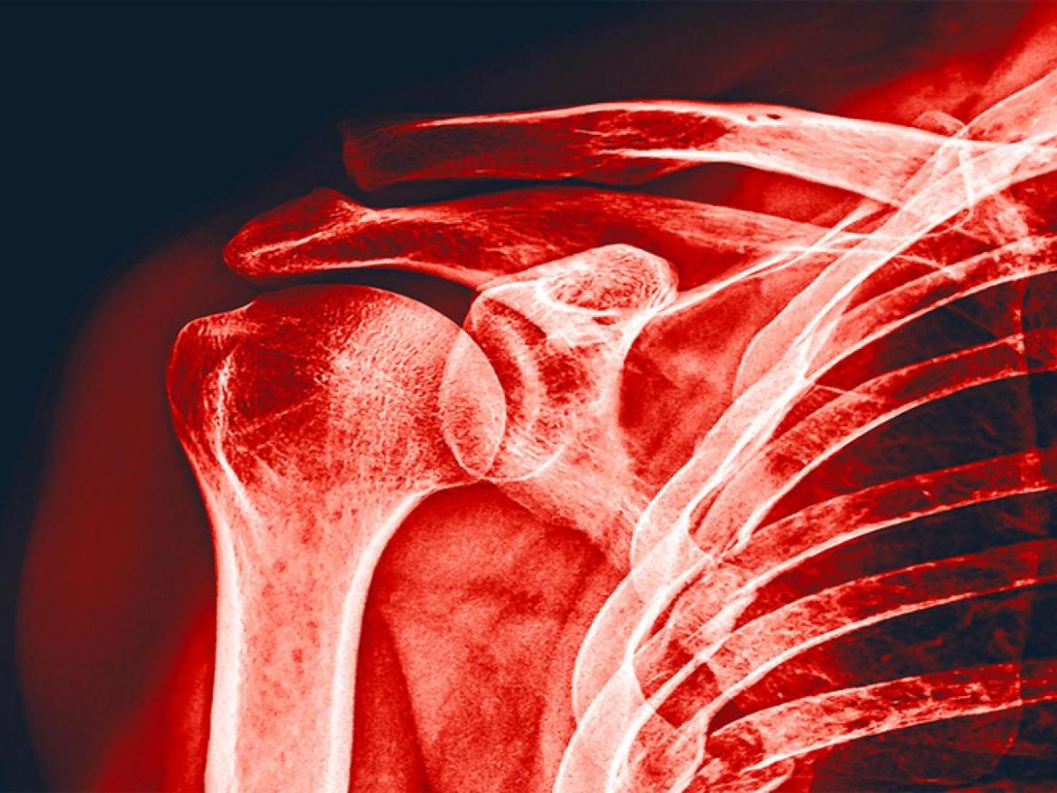 Research Tuesdays: Revolutionising radiation protection