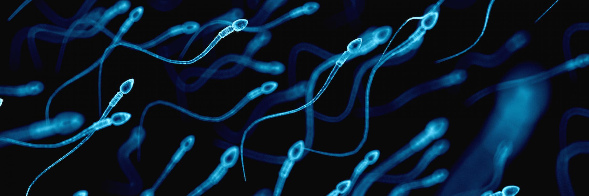 Sperm 