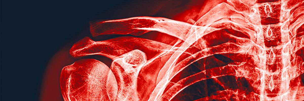 Revolutionising radiation protection