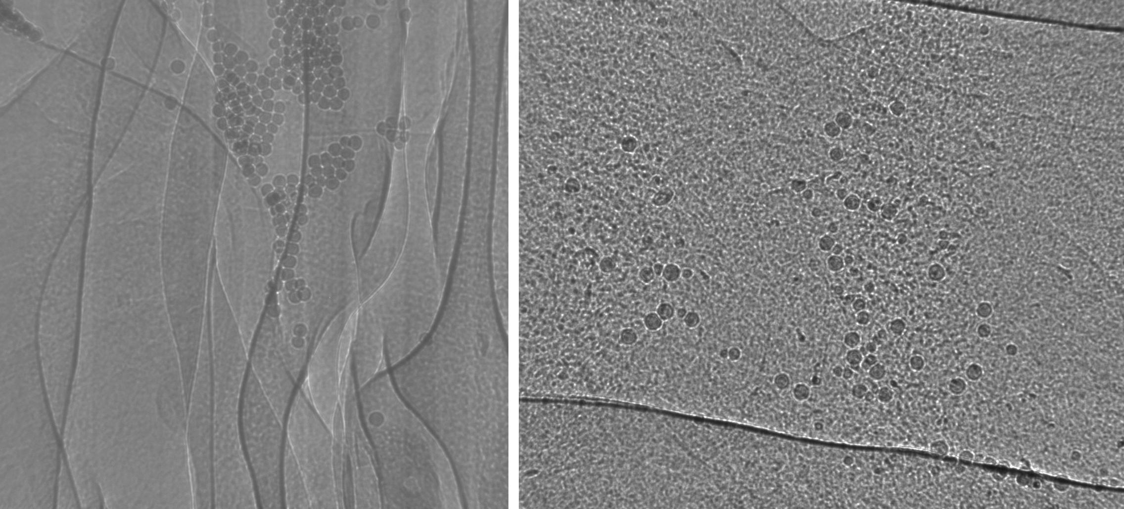 Cystic Fibrosis Airway Research Group and Respiratory X-Ray Imaging ...