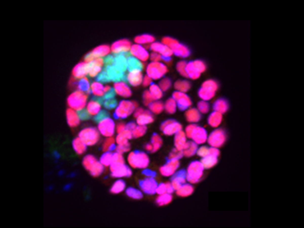 embryo