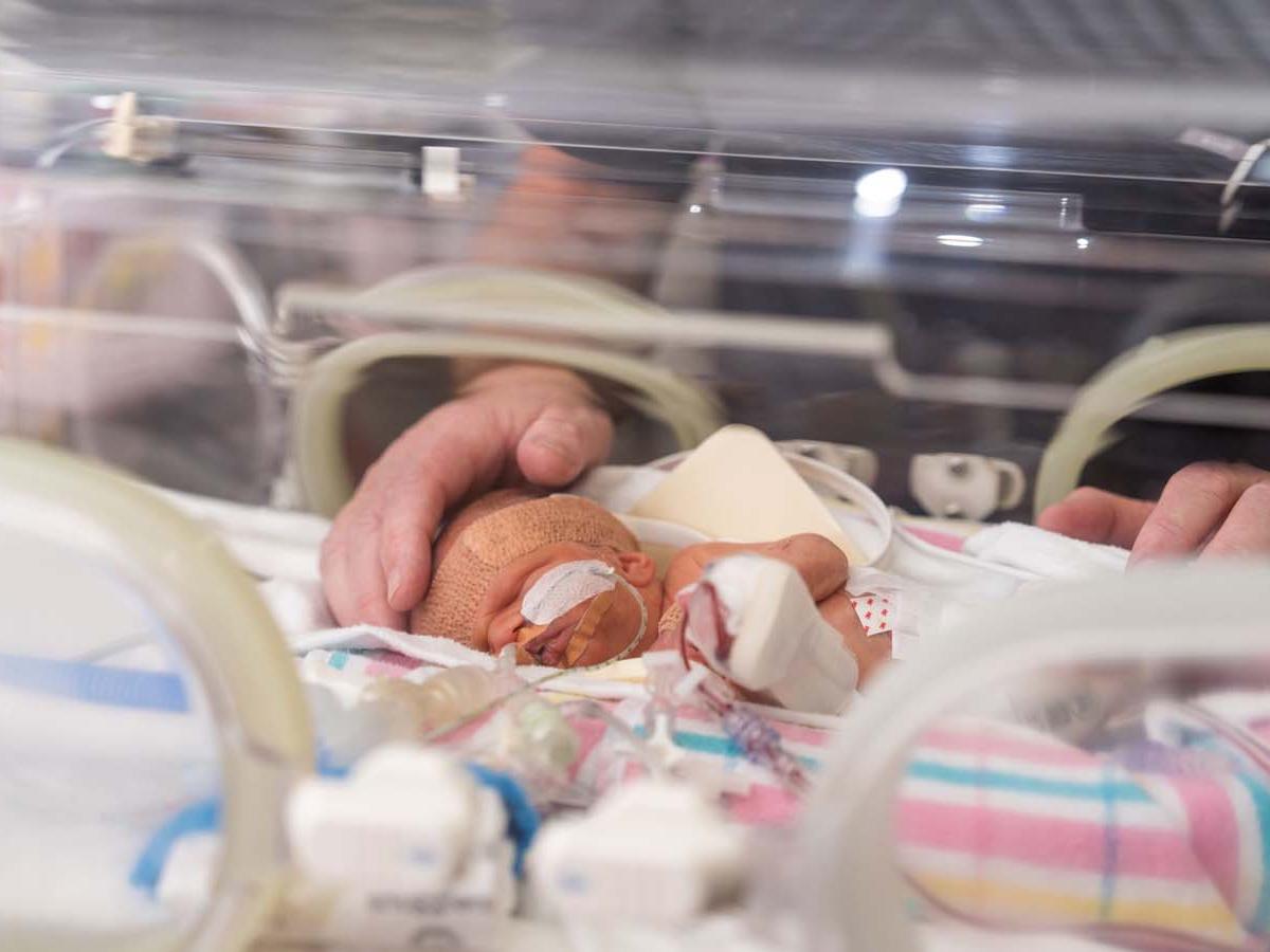 Premature baby