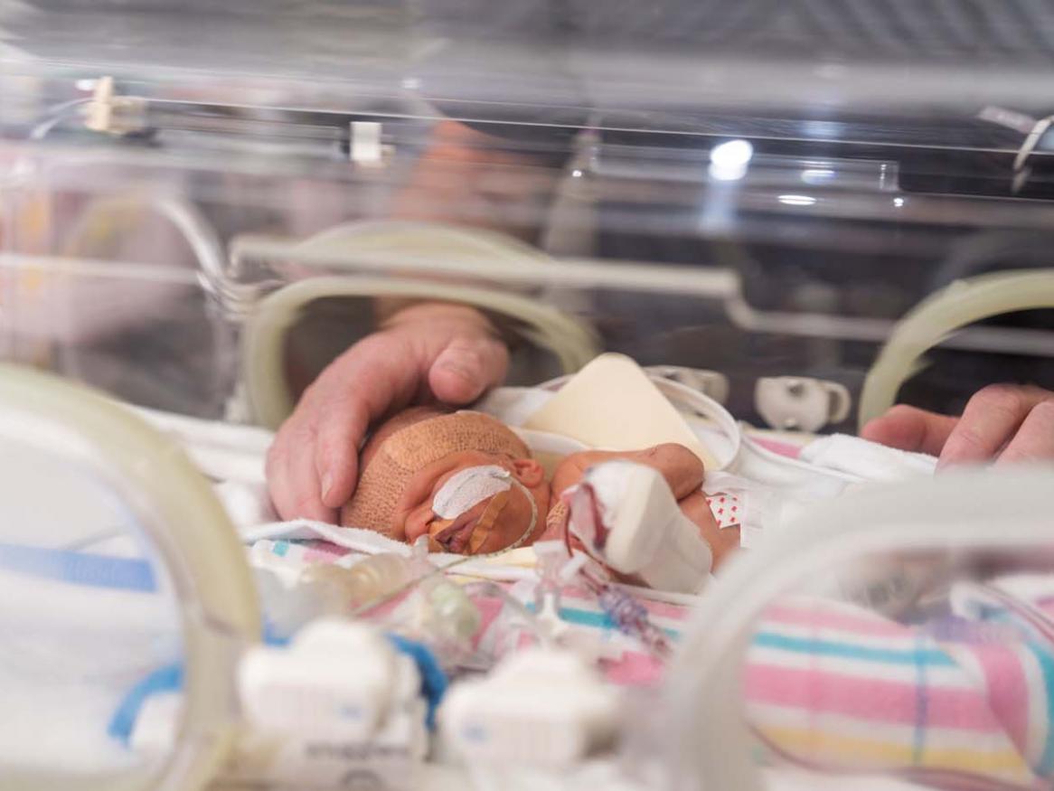 Premature baby