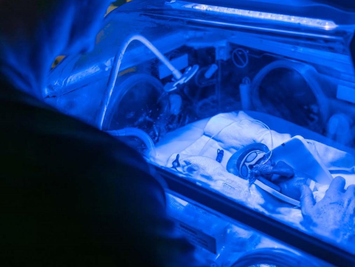 Premature baby 
