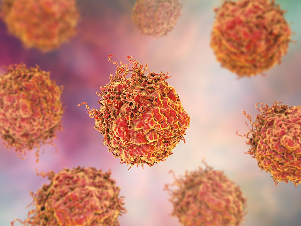 Tumour Inflammation and Immunotherapy