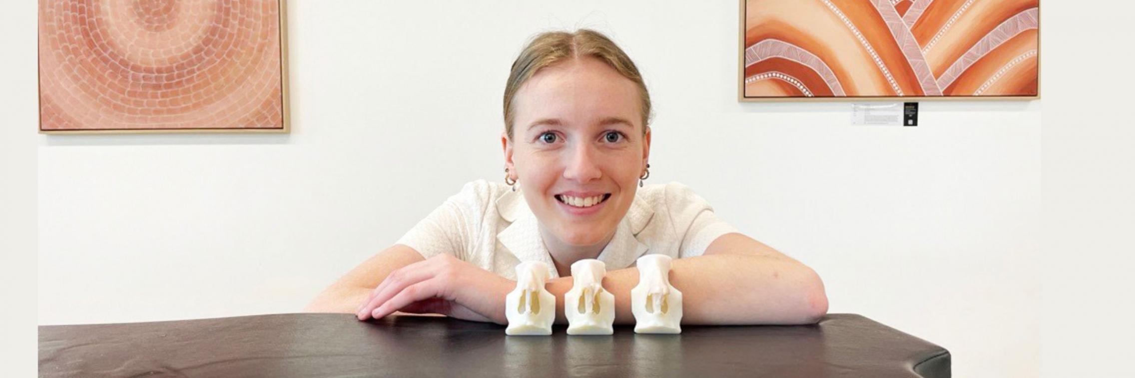 Natasha and her prosthetic noses