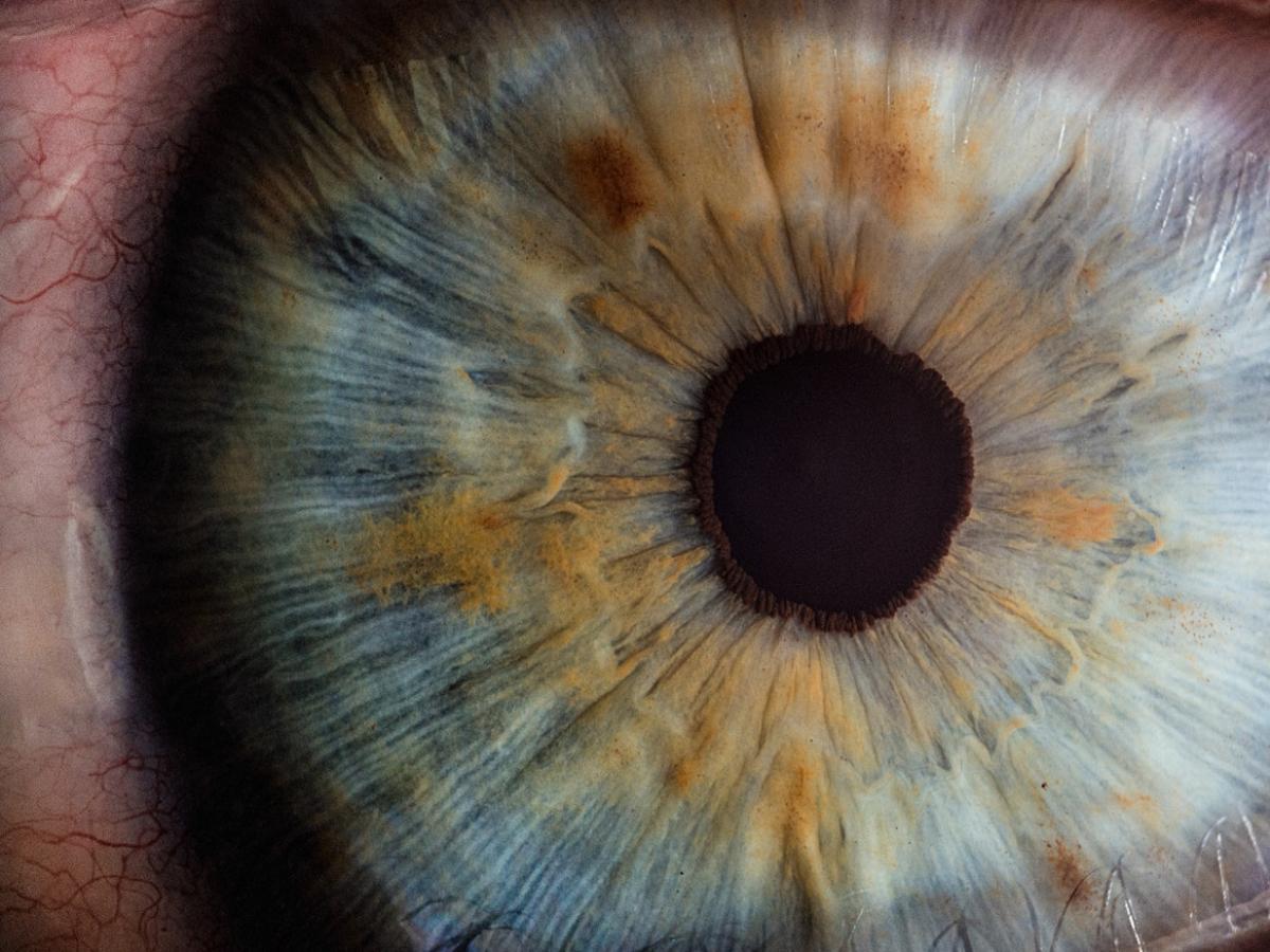 A close-up of an eye.