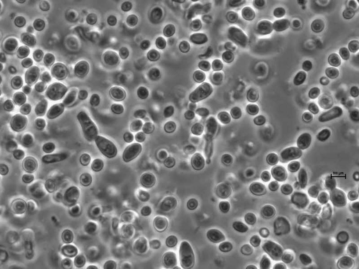 Yeast cells under microscope
